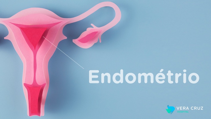 Blog Hospital Vera Cruz - Endometriose - O Endometrio imagem