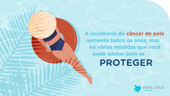 Blog Hospital Vera Cruz - Dia de Combate ao Cancer - Cancer de Pele - Protecao