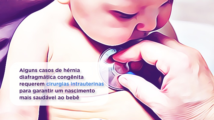 Blog Hospital Vera Cruz - Medicina Fetal - hernia diafragmatica congenita