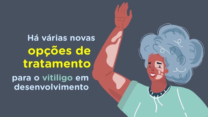 Blog Hospital Vera Cruz - Interno - Dia Internacional do Vitiligo - Novas opcoes de tratamentos